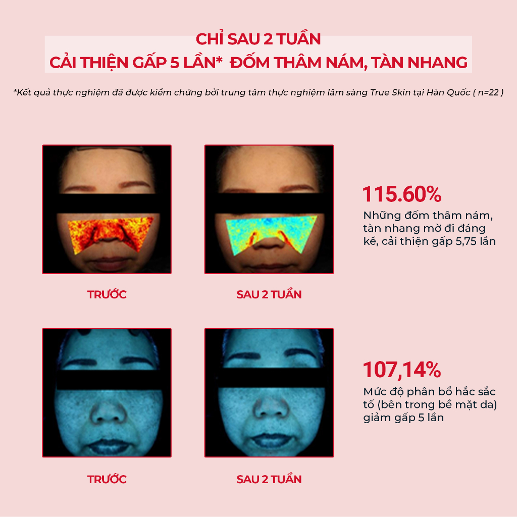 Kem Dưỡng Trị Nám Angel's Liquid Tranexamic Mela Zero 50ML - Ảnh 4
