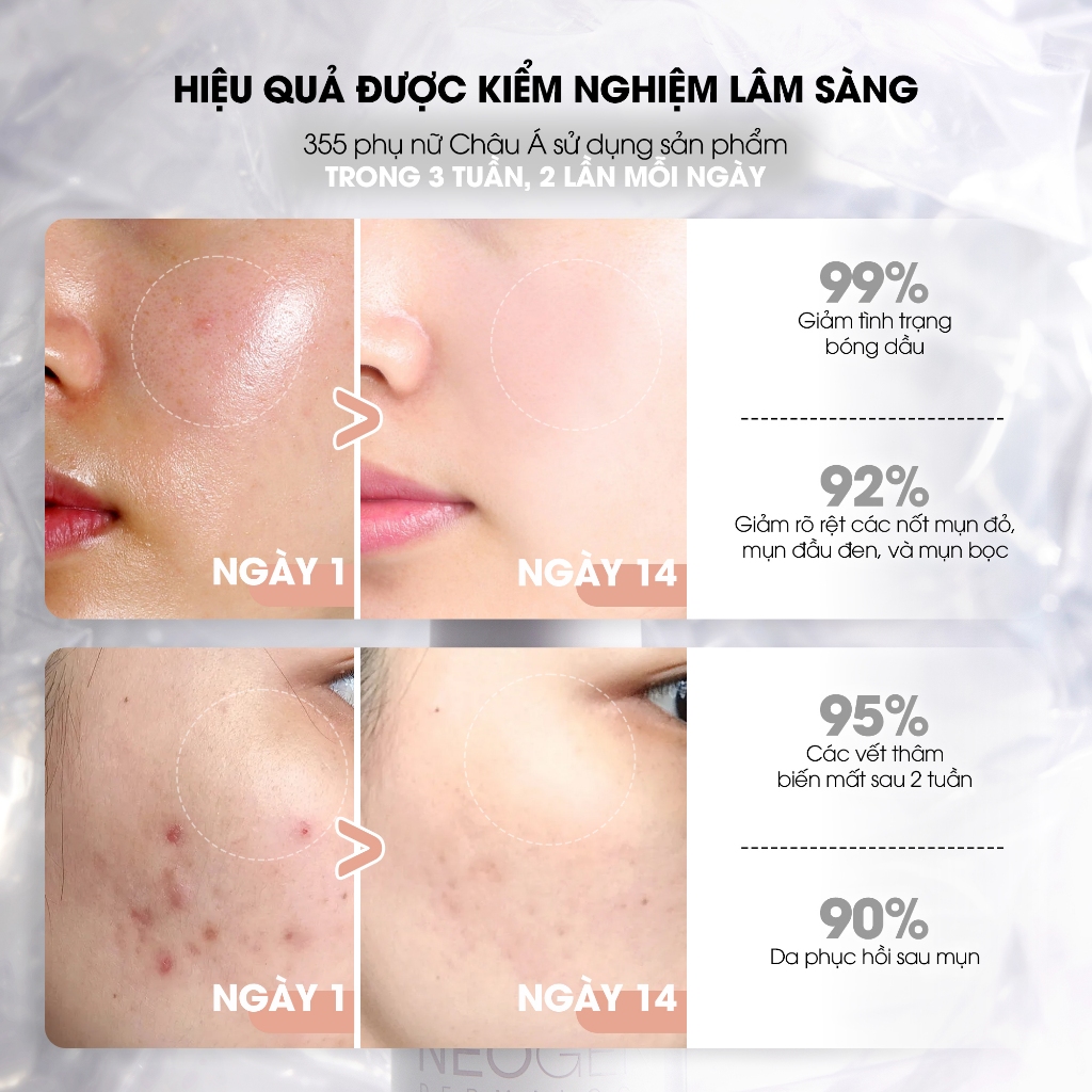 Tinh chất Niacinamide 15% Kiềm Dầu Giảm Mụn Dưỡng Sáng Da Neogen Dermalogy Real Firming 30ML - Ảnh 8