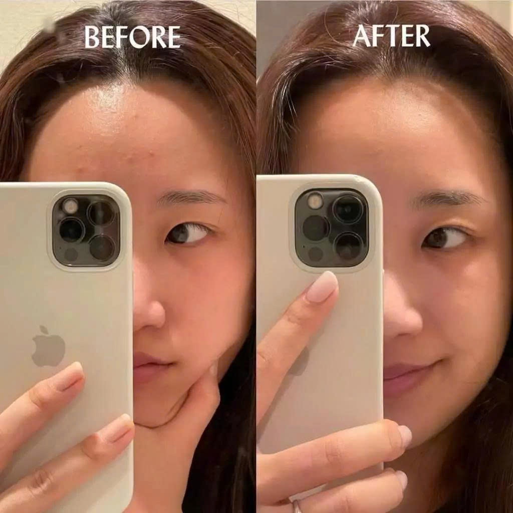 Serum Retinol Hỗ Trợ Chống Lão Hóa, Mờ Nếp Nhăn Cho Da Nhạy Cảm Advanced Clinicals Anti-Wrinkle 52ML - Ảnh 5
