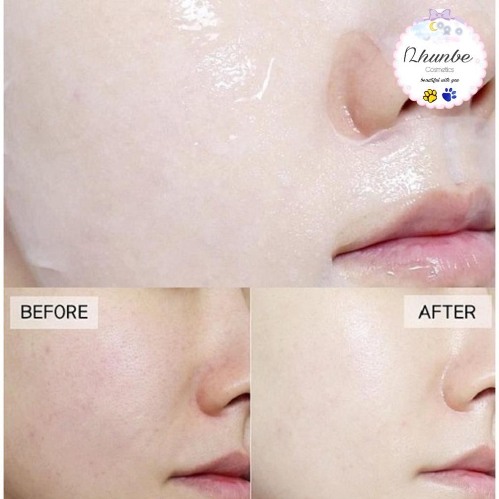 Hộp 10 Mặt Nạ Sáng Da Vitamin C BNBG Vita Whitening Jelly Mask 30ML - Ảnh 2