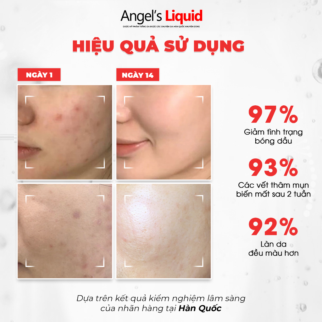 Nước Thần Angel’s Liquid Glutathione + Niacinamide Cica Essence 150ML - Ảnh 5